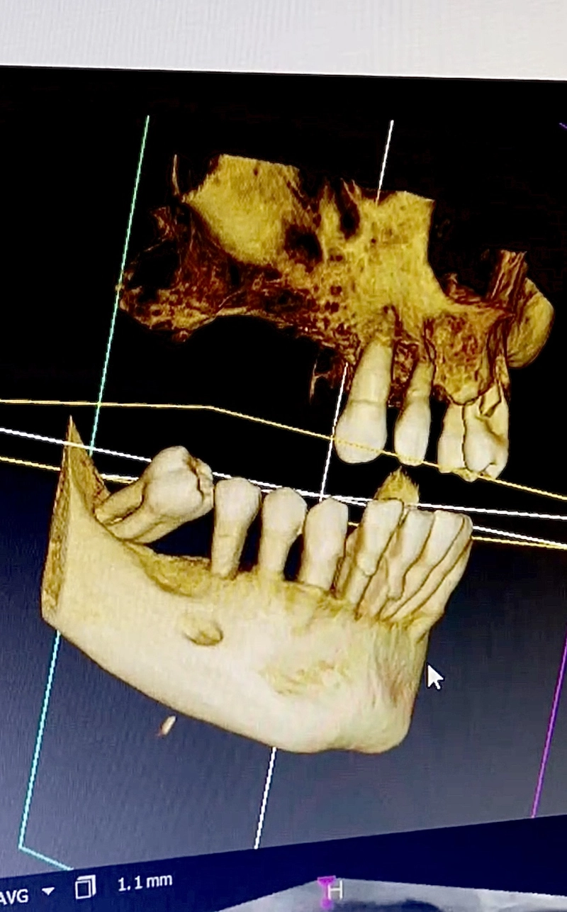 DIGITAL DENTISTRY – PRECISE PLANNING, PREDICTABLE RESULTS